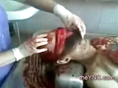 Inside of a Dirty Morgue Creepy Autopsy of an Elderly Male