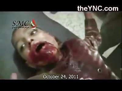 Shocking  Video of Young Boy riddled with Bullets in Shock and Taking his Final Breaths (Video is Graphic!)