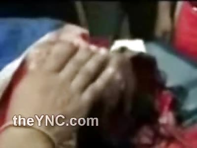 Mans Brain Squeezed out of His Head