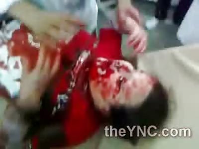 SAD: Poor Girl Shredded by a Nail Bomb Cries for Her Mom