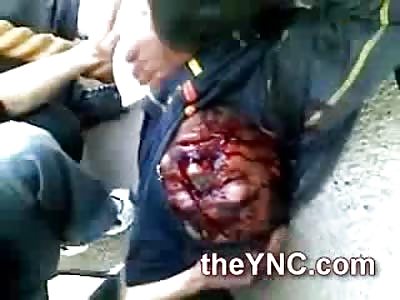 Head Pop After Sniper Shot