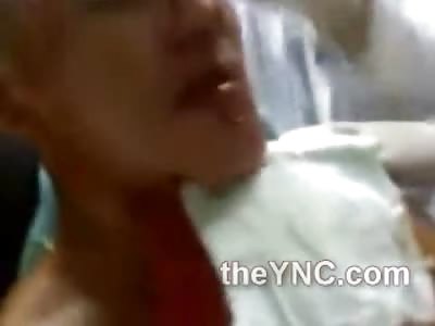 FAILED Suicide Attempt with a Shotgun has the Victim Wishing he was Dead