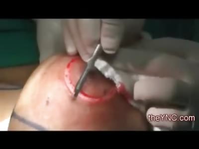 Girl with Great Set of Boobs has a Reduction