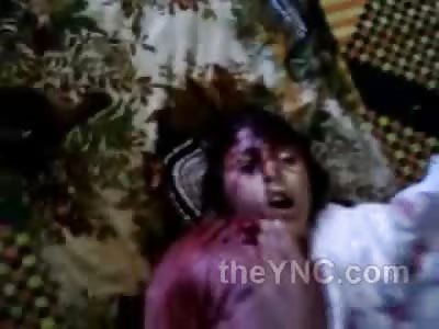 Poor Little Arabic Girl Shown off by Her Family after Being Horrifically Killed 