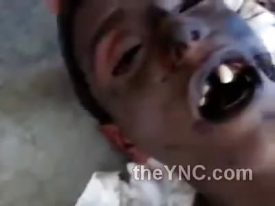 Buck Tooth Kid Shot to Death During Syrian Riots