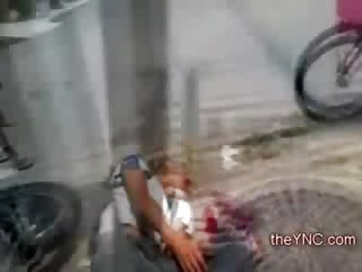 Biker with Severed Foot waits for Help to Arrive after Accident