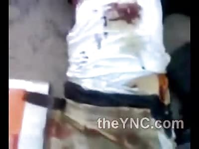 They Guys Must have Been Hit with a Bazooka?