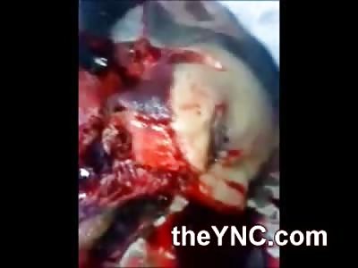 Head Completely Blown Off ..... OUCH