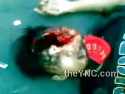 Head Split Open ... Brains On the Road....Girl Filming Crying her Eyes Out