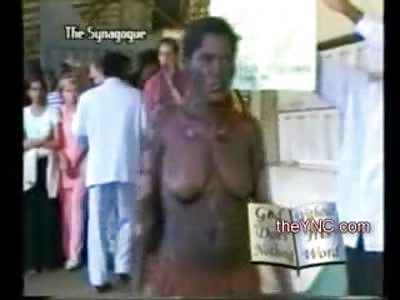 Woman with Bizarre Skin Disease Vomits Disgusting Crap out of her Mouth