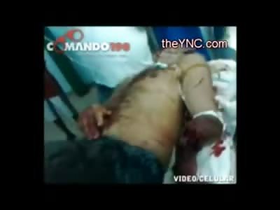 Can We Help this guy? Man with Horrific Arm Injury just wants us to do Something??!