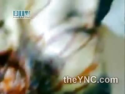 Perfect Headshot Leaves Damn Near Perfect Hole in His Head