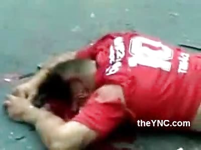 Horrible Bloody Aftermath of Man Dead After Horrific Accident