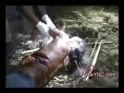 Man Shot in the Face, and then almost Cut in Half by an Axe