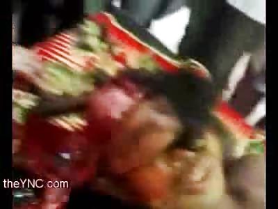 Hammer and Chisel Autopsy of Male is Quite Gruesome