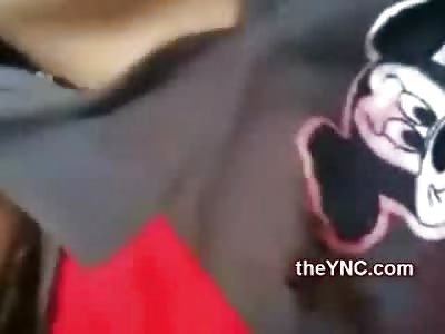 Boy has Fatal Bullet Hole through his Mickey Mouse Shirt