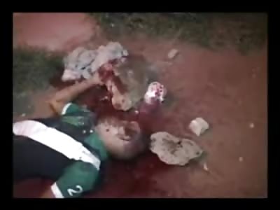 Teenager's Face Crushed and Disfigured from Brutal Stoning Death