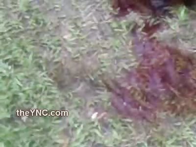 Discombobulated Mans Face Peeling off After Accident