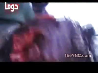 Head Shot Leave Huge Hole in his Head.... Geez