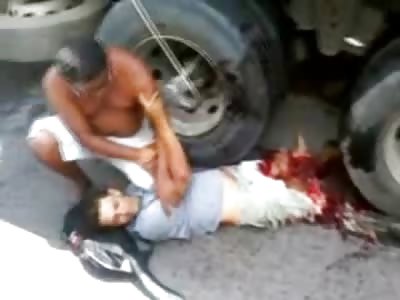 A LIVING HELL: Boy with both Legs Shredded Pleads for Help