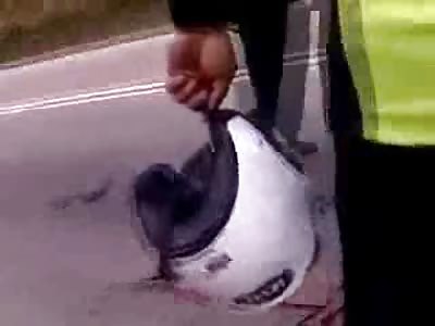 Another Reason not to Ride Motorcycles....Leg Twisted, Mangled and all around Fucked Up