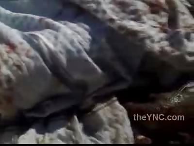 This man has had better days...Face and Body Eaten Away