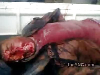 HORROR: Mans Face Ripped off ..This is Disgusting