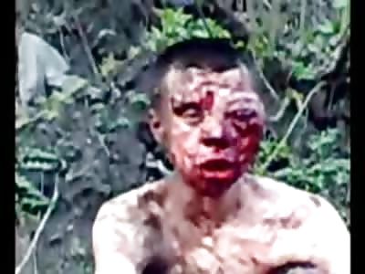 This Kid got his ASS KICKEd by Someone...Wow