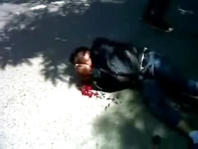 My Eye!! Man hit by Car has Dangling Eye and is thrown into the Back of Pickup Truck