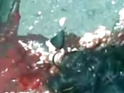 Deceased Woman Peeled off of Pavement has her Brains fall out as she is Moved