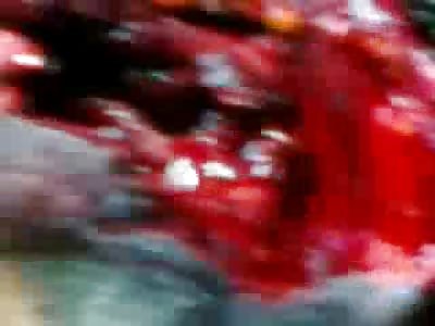 HORROR Update: Man speaking Unintelligible and Crying with Neck Blown Open by Rocket Attack