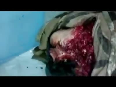 COMPLETE SHOCK: Head is Beyond Recognizable Completely Ripped to Shreds