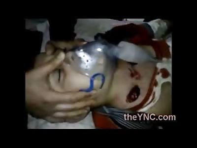 SAD: Little Boy Dying on Table Crying for his Mom and Allah with Huge Holes in his Neck