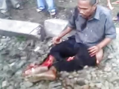 What Now?.....Man in a state of Bewilderment after a Failed Suicide Attempt and everyone just Staring....