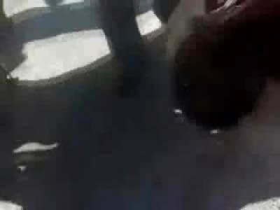 Zombie Man, Civilian shot by Tank Fire still barely Breathing 