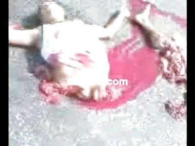 Man Ripped in Half still Moving his Face by Electric Impulse to the Brain