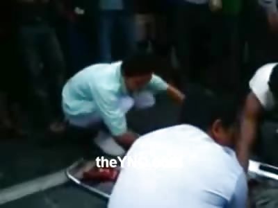 Female entire Lower Half Skinned to the Guts in taken away on Stretcher after her Fatal Accident