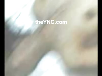 Naked Female with Crushed Head is Viewed on Table by Medical Examiner