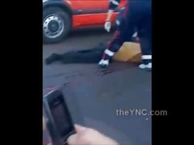 Foot Severed Left Dangling from Horrible Accident