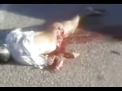 Man with Leg ripped off Clean Off is Removed from the Street