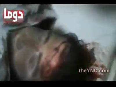 Head Exploded with Rocket Shown off in Morgue