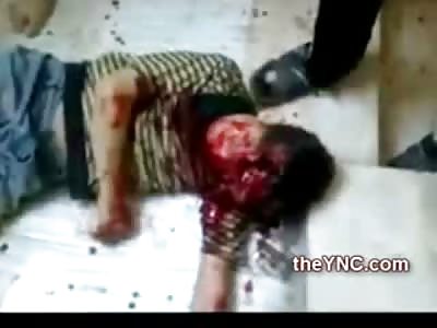 SAD: Poor Kid Shot in the Head Bleeds with HUGE Hole in his Forhead