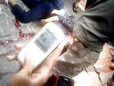 More Footage of Girlfriend Faces Ripped off After She's Pulled off of Boyfriend....Look at all the People Filming