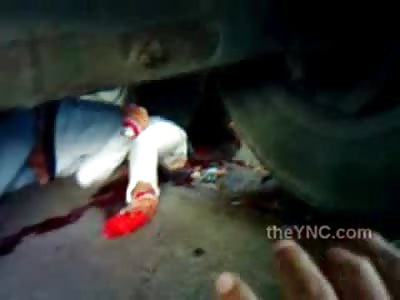Females Head Crushed by Truck Tire.... with Disgusting Close ups
