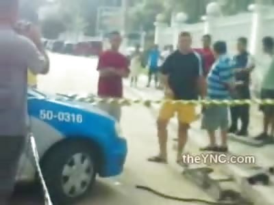 Huge Gapping Hole in Mans Head after Accident