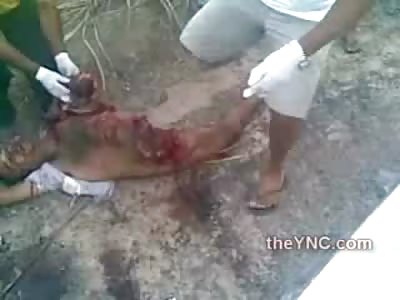 Absolutely Disgusting remains of Man Legless and Armless on the Road