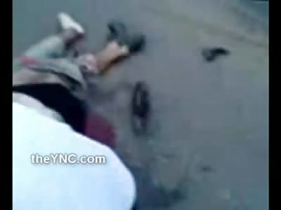 NASTY: Man Has Horrific Hole in is Rectum after Motorcycle Accident