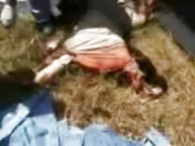 Wow...Guy Falls Apart as EMT's Move him off of the Grass in Gorey Aftermath