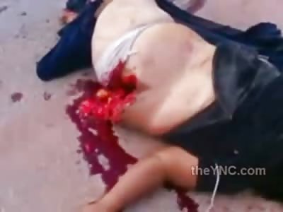 Woman with Huge Hole in her Stomach ...Pouring out on Road