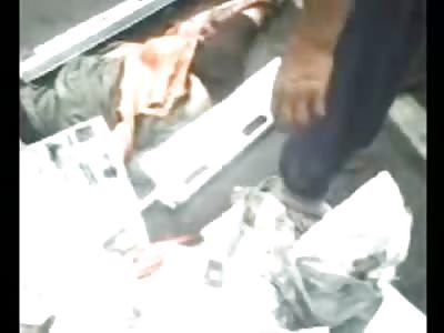 Pretty Female Turned over Legs Mangled to Nothing 